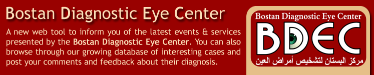 Bostan Diagnostic Eye Center