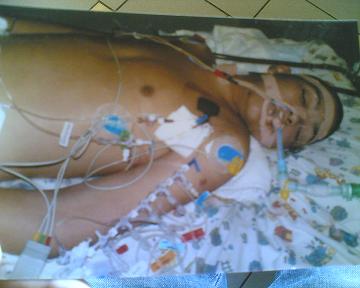 7 weeks in hospital...12 times ressusitated...4 life threatening illnesses...2 opperations...