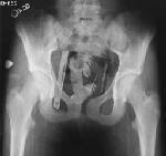 Our Photoshop X-Ray Winner