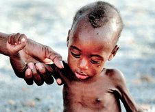 AFRICA: uno de los paises que mas sufre el hambre y las enfermedades terminales