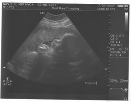 Ultrasound July 24, 2007