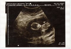 More Pics of the Fetus