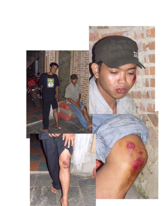 Cilutung Victims of the "Japanese Dogbite"