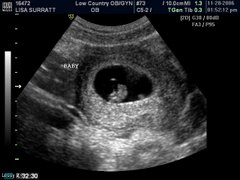 Our 1st Ultrasound