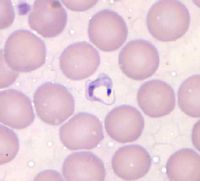 Trypanosoma cruzi en extendido de sangre, protozoario causante de la Enfermedad de Chagas