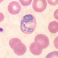 Trofozoito de Plasmodium vivax en el interior de un eritrocito, protozoario causante de la Malaria