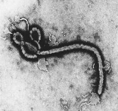 Virus del Ebola, causante de fiebre hemorrágica
