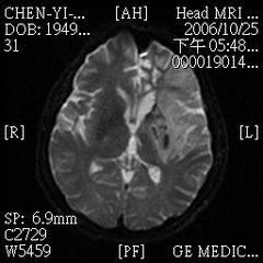 MRI -- My master