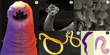HUMAN PARASITES