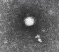 Virus de la Hepatitis C
