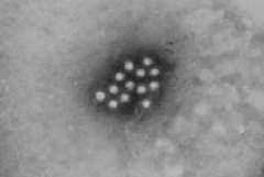 Virus de la Hepatitis A