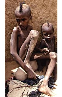 Malnutrition in Sub-Saharan Africa