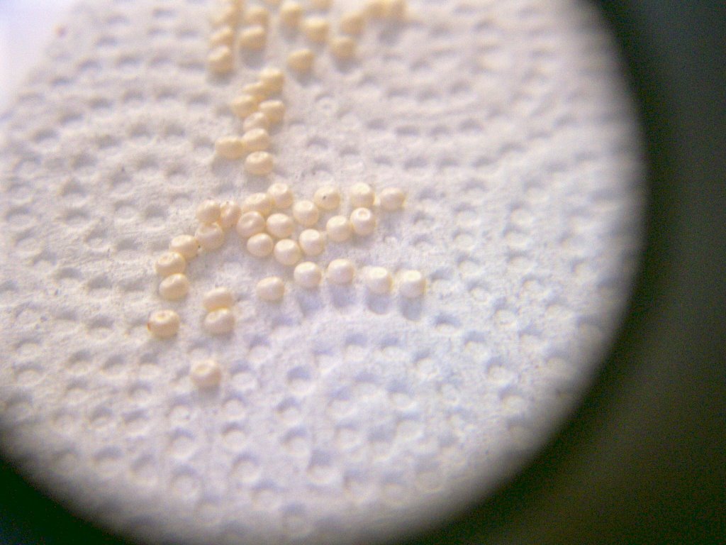 Яйца моли. Яйца платяной моли. Яйца платяной моли под микроскопом. Белые круглые яйца насекомых.