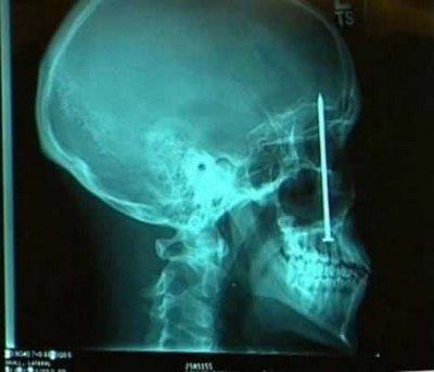 Bizarre X-Rays