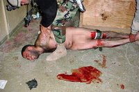 Washington Post: An Iraqi detainee appears to be restrained after having suffered injuries to both legs at Abu Ghraib. 