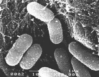 Bacterias vistas al microscopio electrónico
