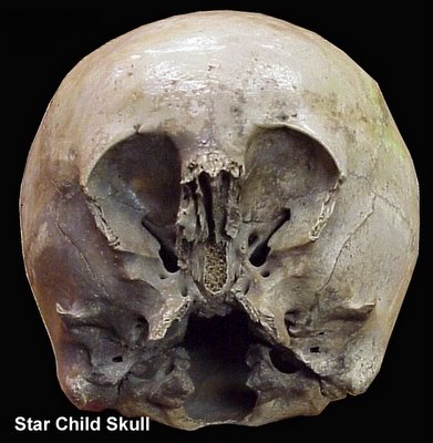 Star Child Skull
