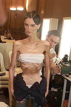 skinny fashion model