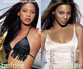 Beonce Knowles Pictures Before and After Plastic Surgery