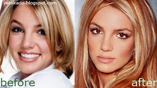 Britney Spears Pictures Before and After Photos Nose job