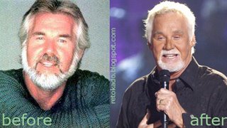 Kenny Rogers Picture Before and After Plastic Surgery