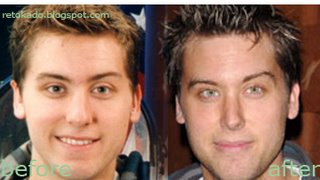 Lance Bass Gay and Nose Plastic