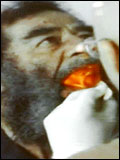 Saddam Hussein Visits the Dentist