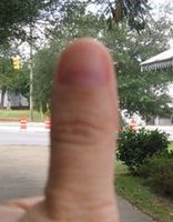 Thumb Close