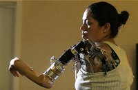 Woman with a bionic arm.