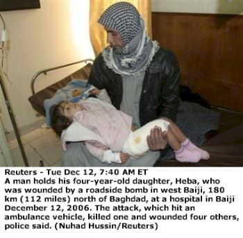 4 year old Iraqi girl injured in bombing