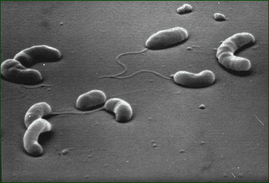 Vibrio cholerae, bacteria causante de la enfermedad del Cólera