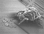 A view of a Spider Mite approaching a gear chain