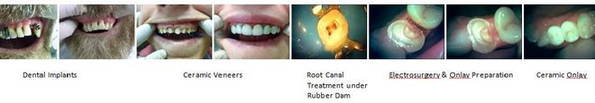 Dental treatments done at www.delhidentist.in